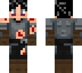 wounded oakstead solider (1)