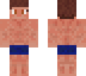 sunburn hurts