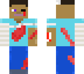 injured steve