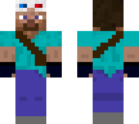 my skin !!