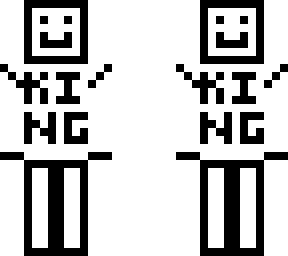king smile